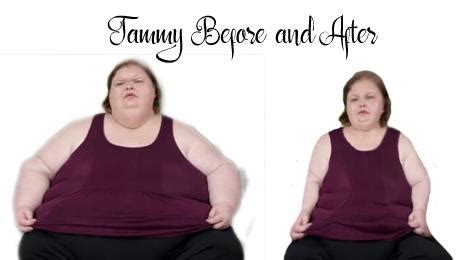 Tammy Before and After : r/1000lbsisters