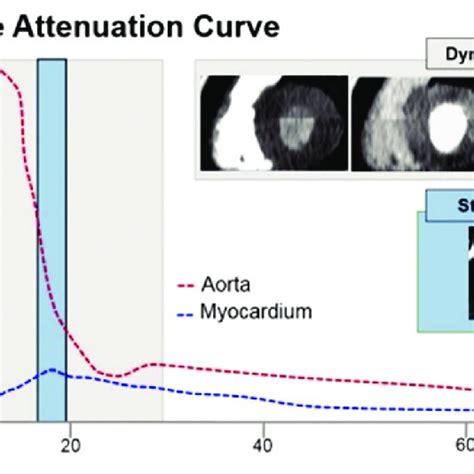 CT Myocardial Perfusion Imaging Static And Dynamic CT Perfusion