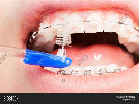 Using Interdental Image & Photo (Free Trial) | Bigstock