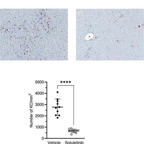 A Immunohistochemical Labeling Of Liver Macrophages Kupffer Cells