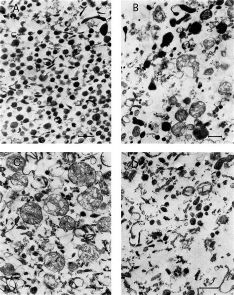 Electron Micrographs Of Granule Fractions From Tumours And Adrenal