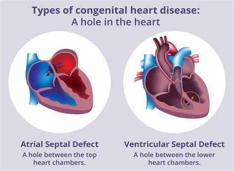 congenital heart disease types symptoms  diagnosis pregnancy