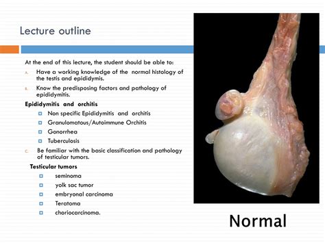 Ppt Testicular Pathology Powerpoint Presentation Free Download Id