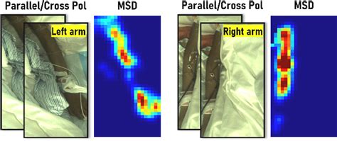 Figure 13 From Multispectral Depolarization Based Living Skin Detection