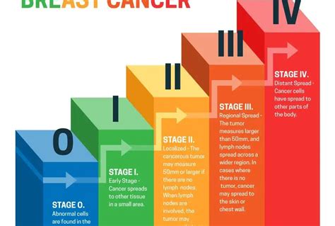 Breast Cancer Stages: Understanding the Journey - Pinkribbon