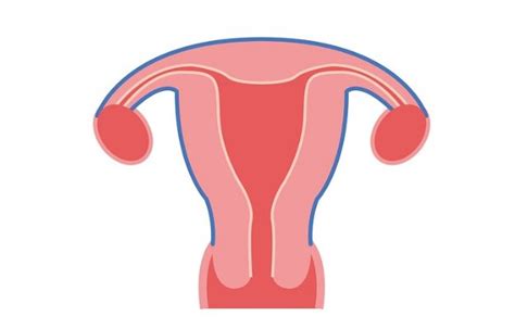 Endometrial Hyperplasia symptoms, causes, treatment, medicine ...