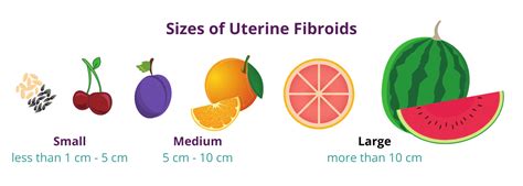 fibroid tumor sizes  visual guide usa fibroid centers mex alex