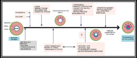 Physiopathology Several Factors Can Induce Vascular Calcification And