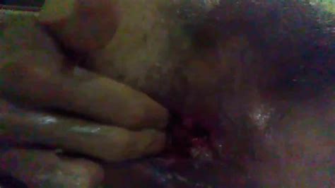 My Anal Prolapse Gay Amateur Amateur Porn Xhamster