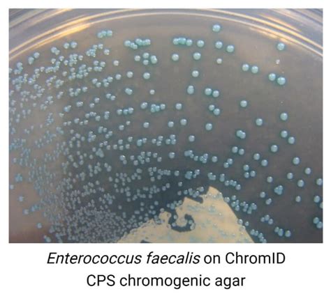 Enterococcus Faecalis A Comprehensive Guide