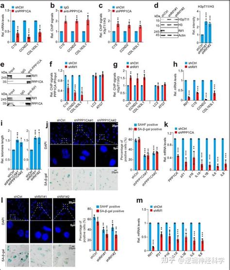 Cell Discov︱湖北大学李珊珊 余希岚团李珊珊 余希岚团队发现糖代谢调控自噬与端粒结构的新机制 知乎