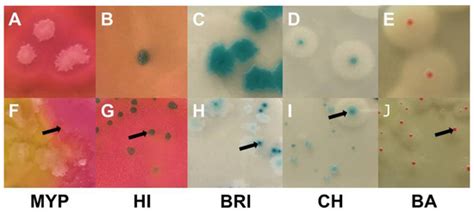 Performance Testing Of Bacillus Cereus Chromogenic Agar Media For