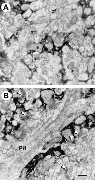 Immuno Electron Microscopic Localization Of Egfp In The Molecular Layer