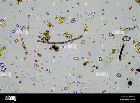 Hyphae Of Fungi Microscope