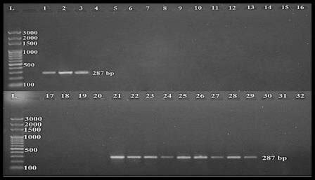 Ethidium Bromide Stained Agarose Gel Electrophoresis Of Monoplex Pcr