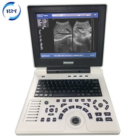 Full Digital Ultrasonic Diagnostic Imaging System B W Portable