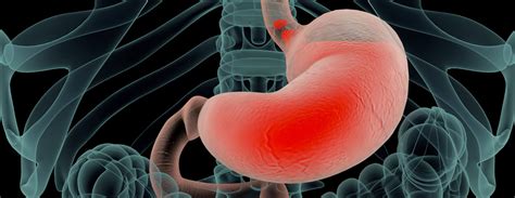 Suco Gastrico Na Garganta - Qual a cor do suco gástrico? - Cetro Concursos
