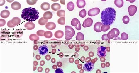 Haematology in a NutShell: Basophils