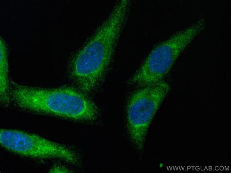 CRMP2 antibody (CL488-14686) | Proteintech 