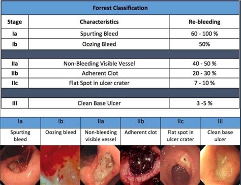 Forrest Classification Of Upper Gi Bleeding Mdcalc