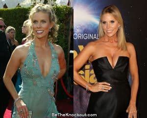 Cheryl Hines Plastic Surgery Comparison Photos