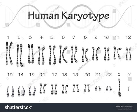 human karyotype diagram chromosomes stock vector royalty
