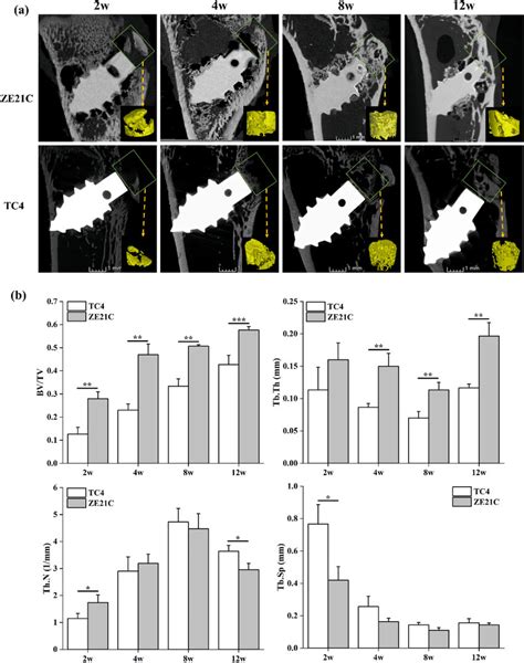 Micro CT Analysis Of The Suture Anchor And Bone Mass Above The Suture