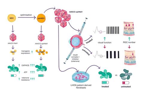 Novel gene therapy shows promise for treating multiple eye diseases