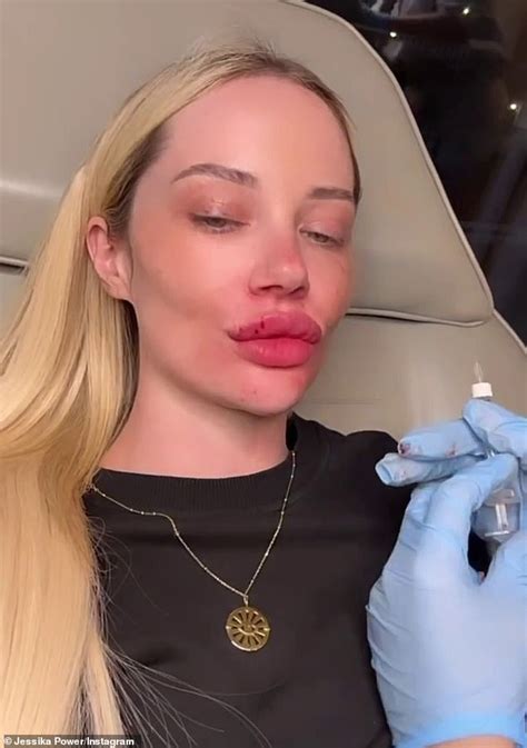 Married At First Sight Star Jessika Power Gets Her Lips Filled Again