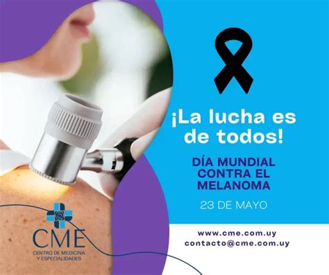 Día Mundial Contra El Melanoma Cme