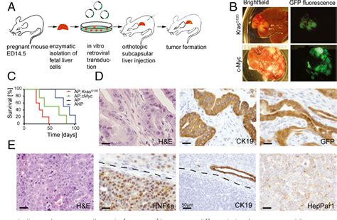 Figure 1 From Mouse Model Of Intrahepatic Cholangiocarcinoma Validates