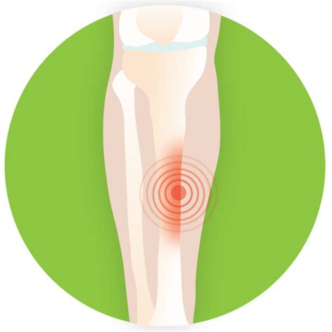 Shin Splint Treatment Orthoquest