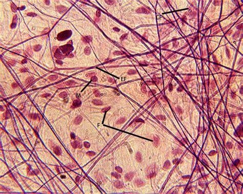 Reticular Connective Tissue Under Microscope