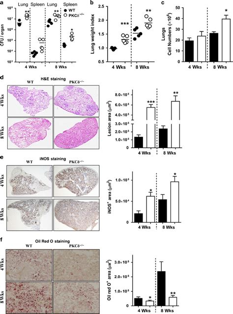 Protein Kinase C Delta Pkcδ A Marker Of Inflammation And Tuberculosis Disease Progression In