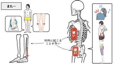 すねの外側が痛い原因とほぐしたいポイント＋対策ストレッチ バレエダンサーさんの治療院