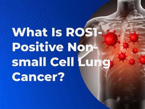 What Is ROS1-Positive Lung Cancer? | Massive Bio