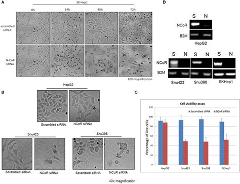 Misfolded Ncor Is Linked To The Growth And Survival Of Hbx Positive