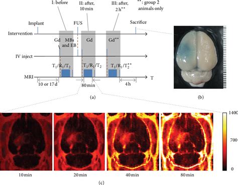 Figure 1 From Pharmacodynamic Analysis Of Magnetic Resonance Imaging