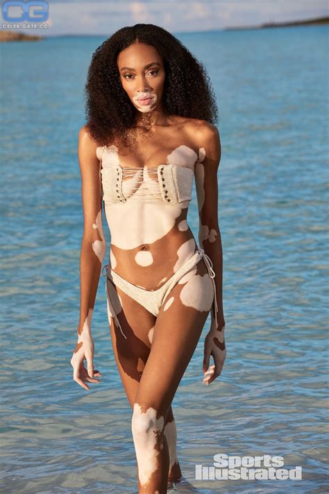 Winnie Harlow Nude Pictures Photos Playboy Naked Topless Fappening