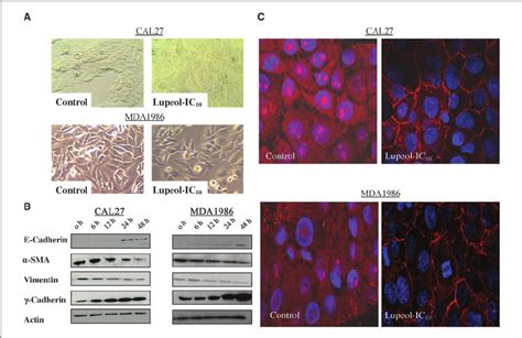 Lupeol Induced Reversal Of NF N Bdependent EMT CAL27 And MDA1986