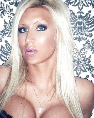 Paris Deluxxe Post Op Porn Pictures XXX Photos Sex Images PICTOA