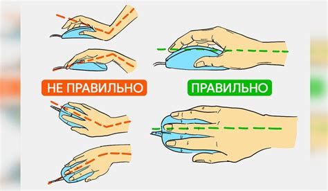Туннельный синдром запястья