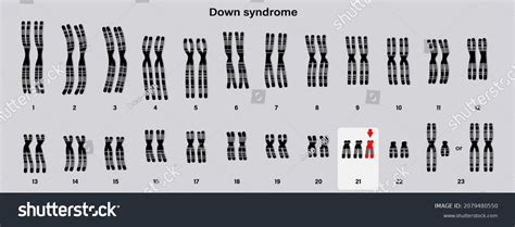 197 Human Chromosome 21 Images, Stock Photos & Vectors | Shutterstock