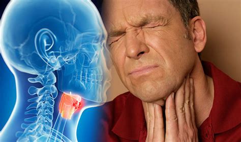 Throat Cancer Symptoms And Signs Are You At Risk Watch Out For A Sore Throat Uk