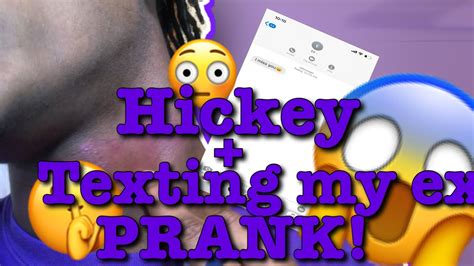 Hickey And Cheating Prank On Girlfriend Youtube