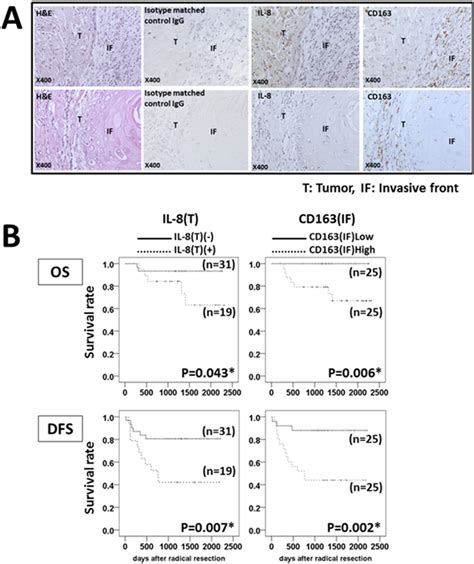 Relationship Between Il 8 Expression Cd163 Positive Cell Infiltration Download Scientific