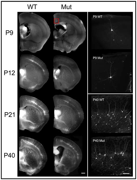 Developmental Progression Of Cortical YFP Expression Left Column 200