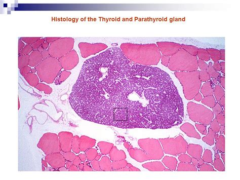 Thyroid And Parathyroid Gland Slide