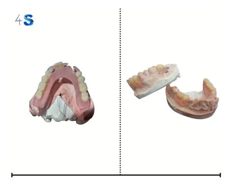 Resina Flexível Para Prótese Dentaria 1kg Parcelamento sem juros