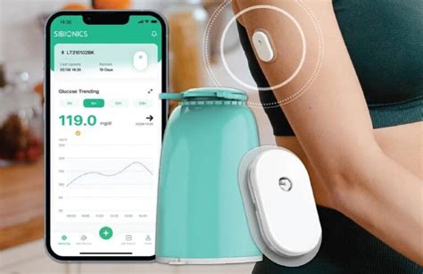 SiBionics wins CE mark for 14-day CGM